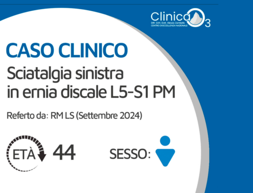 Sciatalgia sinistra in ernia discale L5-S1PM ( Cloned )